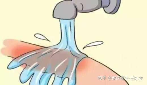 如此剧烈的疼痛如何下载？一分钟教你找到资源。