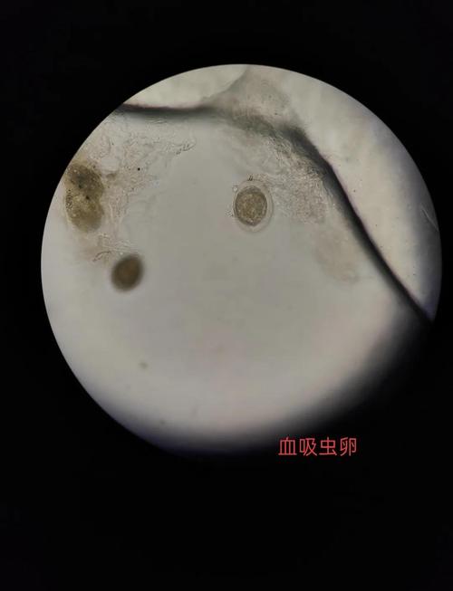 内部寄生虫最新研究有哪些？(快来看看这些新发现)